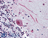 Anti-SLC5A9 / SGLT4 Antibody (Internal) IHC-plus LS-A2790
