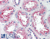 Anti-SLC5A11 / SMIT2 Antibody (Internal) IHC-plus LS-A2798
