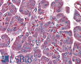 Anti-PAFAH1B1 / LIS1 Antibody IHC-plus LS-B3029