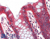 Anti-PLIN1 / Perilipin Antibody (Internal) IHC-plus LS-B3034