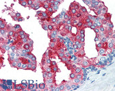 Anti-FOLH1 / PSMA Antibody (clone Y-PSMA1) IHC-plus LS-B3040