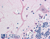 Anti-UCHL1 / PGP9.5 Antibody IHC-plus LS-B3043