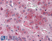 Anti-ROCK2 Antibody IHC-plus LS-B3050