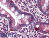 Anti-ST13 Antibody (aa1-369, clone AT1F1) IHC-plus LS-B3054