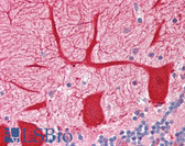 Anti-OPTN / Optineurin Antibody (aa559-575) IHC-plus LS-B3065