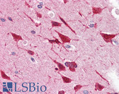 Anti-GRB2 Antibody IHC-plus LS-B3068