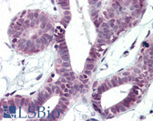 Anti-GATA4 Antibody IHC-plus LS-B3074