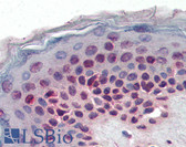 Anti-MSX2 / MSH Antibody (aa84-95) IHC-plus LS-B3082
