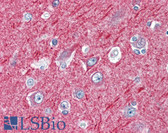Anti-NOVA2 Antibody (aa15-31) IHC-plus LS-B3084