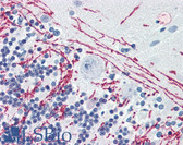 Anti-NOVA1 Antibody (aa21-37) IHC-plus LS-B3085