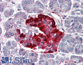 Anti-PDX1 Antibody (aa198-213) IHC-plus LS-B3086