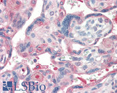 Anti-Laminin Antibody IHC-plus LS-B3103
