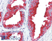 Anti-ACPP / PAP Antibody IHC-plus LS-B3108