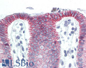 Anti-CTNNB1 / Beta Catenin Antibody (aa758-771) IHC-plus LS-B3110