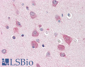 Anti-MYO5B / Myosin VB Antibody (C-Terminus) IHC-plus LS-B3118
