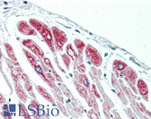 Anti-DES / Desmin Antibody IHC-plus LS-B3122
