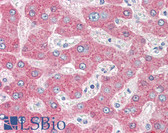 Anti-SERPINA1 / Alpha 1 Antitrypsin Antibody IHC-plus LS-B3128