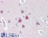 Anti-UBQLN1 / Ubiquilin Antibody (Internal, clone 3D5E2) IHC-plus LS-B3142