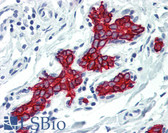 Anti-KRT19 / CK19 / Cytokeratin 19 Antibody (clone BA17) IHC-plus LS-B3148