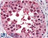 Anti-Cullin 3 / CUL3 Antibody (aa225-275) IHC-plus LS-B3154