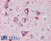 Anti-MNSOD / SOD2 Antibody IHC-plus LS-B3161