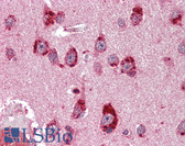 Anti-Mineralocorticoid Receptor Antibody (clone H10E4C9F) IHC-plus LS-B3162