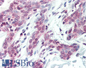 Anti-CTCF Antibody (aa150-200) IHC-plus LS-B3184
