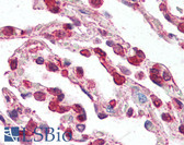 Anti-CCR3 Antibody (N-Terminus) IHC-plus LS-B3185