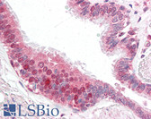 Anti-CFLAR / FLIP Antibody (aa191-209) IHC-plus LS-B3187