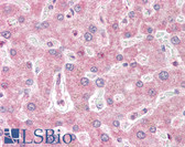 Anti-IRAK2 / IRAK-2 Antibody (C-Terminus) IHC-plus LS-B3188