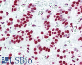 Anti-ACIN1 / Acinus Antibody IHC-plus LS-B3189