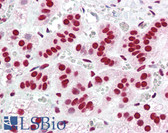 Anti-ACIN1 / Acinus Antibody (aa775-789) IHC-plus LS-B3190