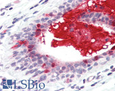 Anti-TNFSF13 / APRIL Antibody (Internal) IHC-plus LS-B3191