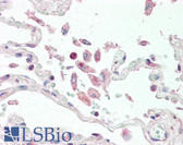 Anti-TNFSF13 / APRIL Antibody (Extracellular Domain) IHC-plus LS-B3193