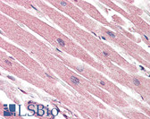Anti-CASP1 / Caspase 1 Antibody IHC-plus LS-B3200