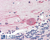 Anti-TLR3 Antibody (C-Terminus) IHC-plus LS-B3204