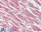 Anti-MAP3K5 / ASK1 Antibody (C-Terminus) IHC-plus LS-B3205