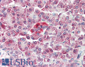 Anti-MAP3K5 / ASK1 Antibody (N-Terminus) IHC-plus LS-B3206