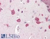 Anti-TSLP Antibody (Internal) IHC-plus LS-B3208