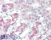 Anti-SLITRK6 Antibody (Internal) IHC-plus LS-B3220