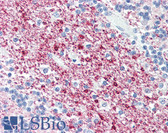 Anti-SIRT2 / Sirtuin 2 Antibody (C-Terminus) IHC-plus LS-B3221