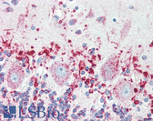 Anti-LIMPII / SCARB2 Antibody (Internal) IHC-plus LS-B3225