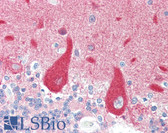 Anti-CRMP1 Antibody (N-Terminus) IHC-plus LS-B3226