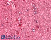 Anti-PEBP1 / RKIP Antibody (C-Terminus) IHC-plus LS-B3230