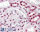 Anti-IRF6 Antibody (C-Terminus) IHC-plus LS-B3231