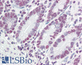Anti-PTBP1 Antibody (N-Terminus) IHC-plus LS-B3235