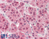Anti-PARP2 Antibody (Internal) IHC-plus LS-B3239