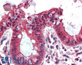 Anti-EZR / Ezrin Antibody (Internal) IHC-plus LS-B3244