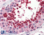 Anti-GPX4 / MCSP Antibody (C-Terminus) IHC-plus LS-B3246