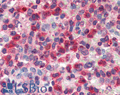 Anti-G6PD Antibody (aa308-320) IHC-plus LS-B3253